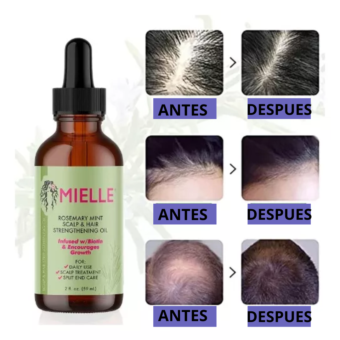 CRECIMIENTO Y NUTRICCION CAPILAR | SERUM MIELLE OFERTA 2X1